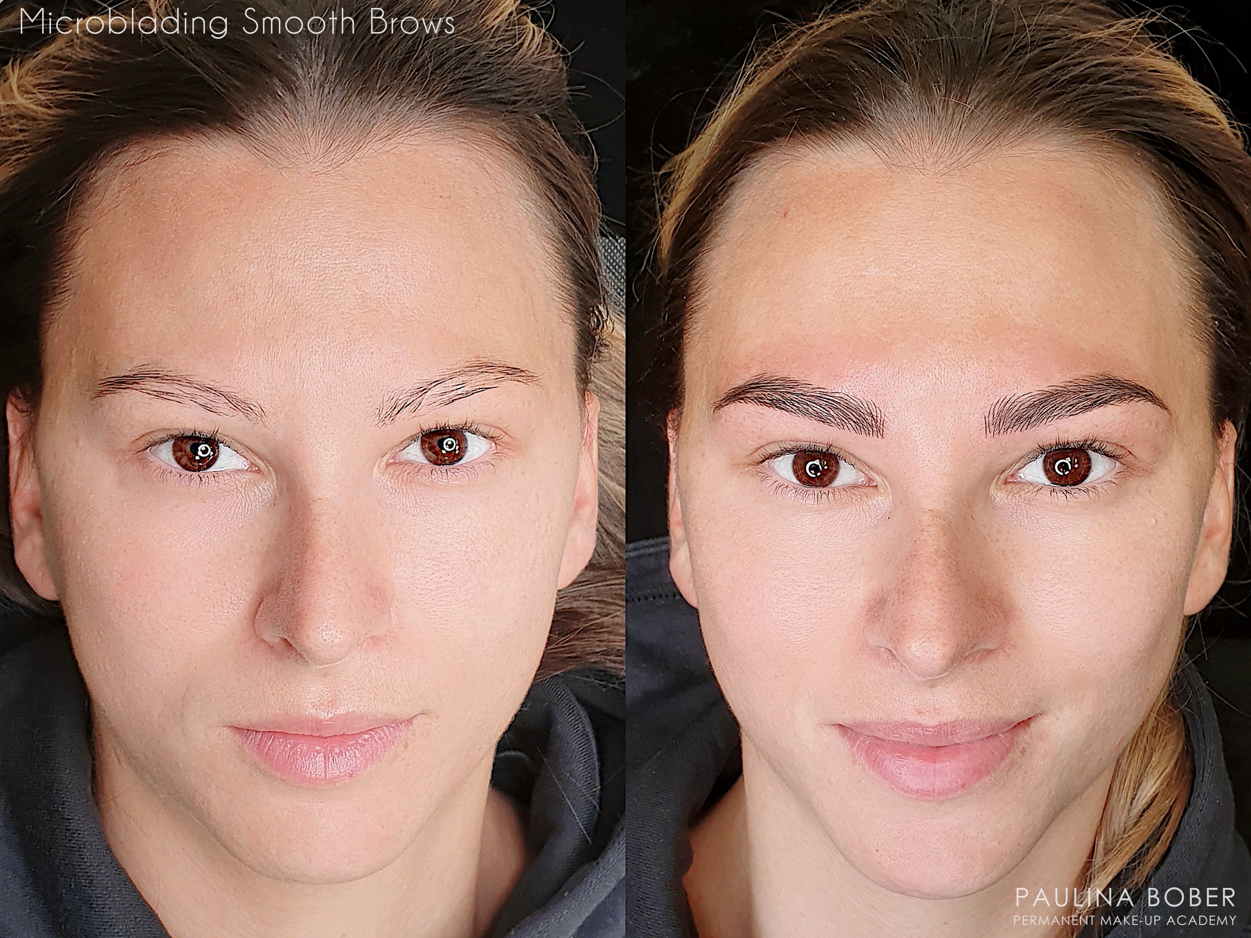 MIDAS #11 Slope 0.20mm Microblading Needle - MICROBLADING - MEI-CHA