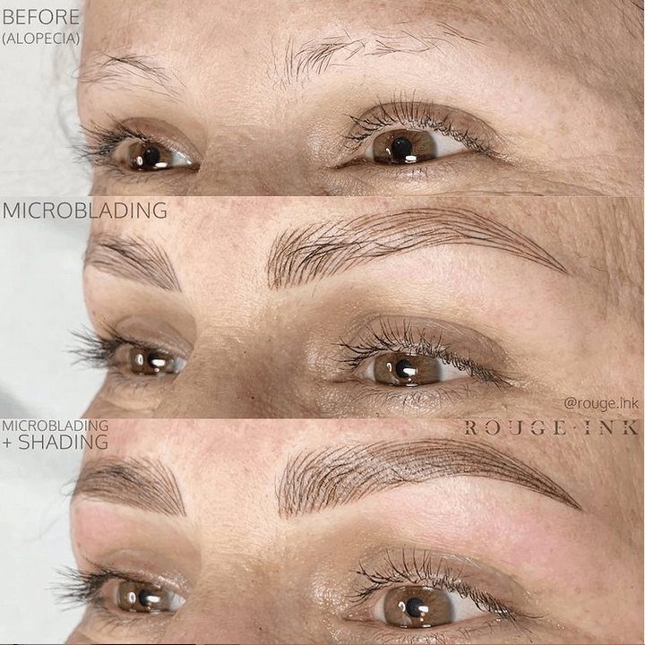 Case Study: The “Combination Brow” Technique for a Complete Brow Resurrection by Rojin Surreah-MEI-CHA